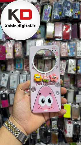 قاب گوشی Redmi A4 شیائومی So Cool طرح Patrick and Bob عروسکی برجسته خانواده پاتریک