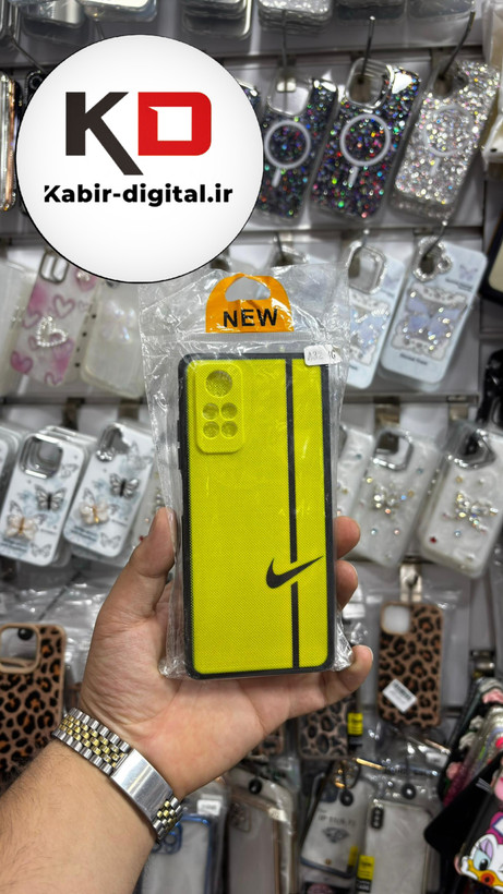 قاب گوشی Redmi Note 11 4G/Note 11s /Note 12sشیائومی فانتزی سوزنی طرحدار