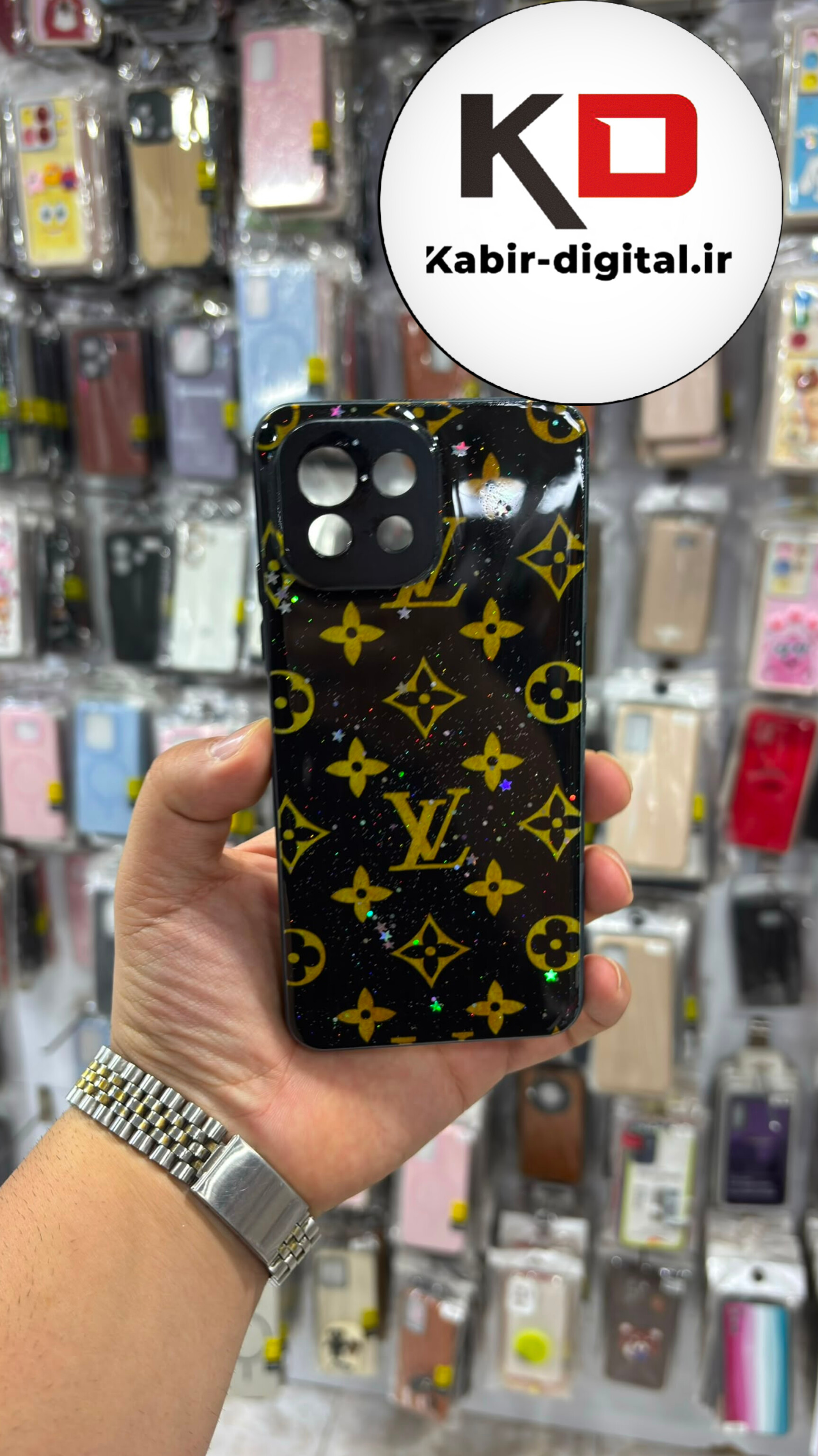 قاب  گوشی MI 11 Lite شیائومی فانتزی برجسته براق طرح لویی ویتون مشکی زرد به همراه پاپ سوکت